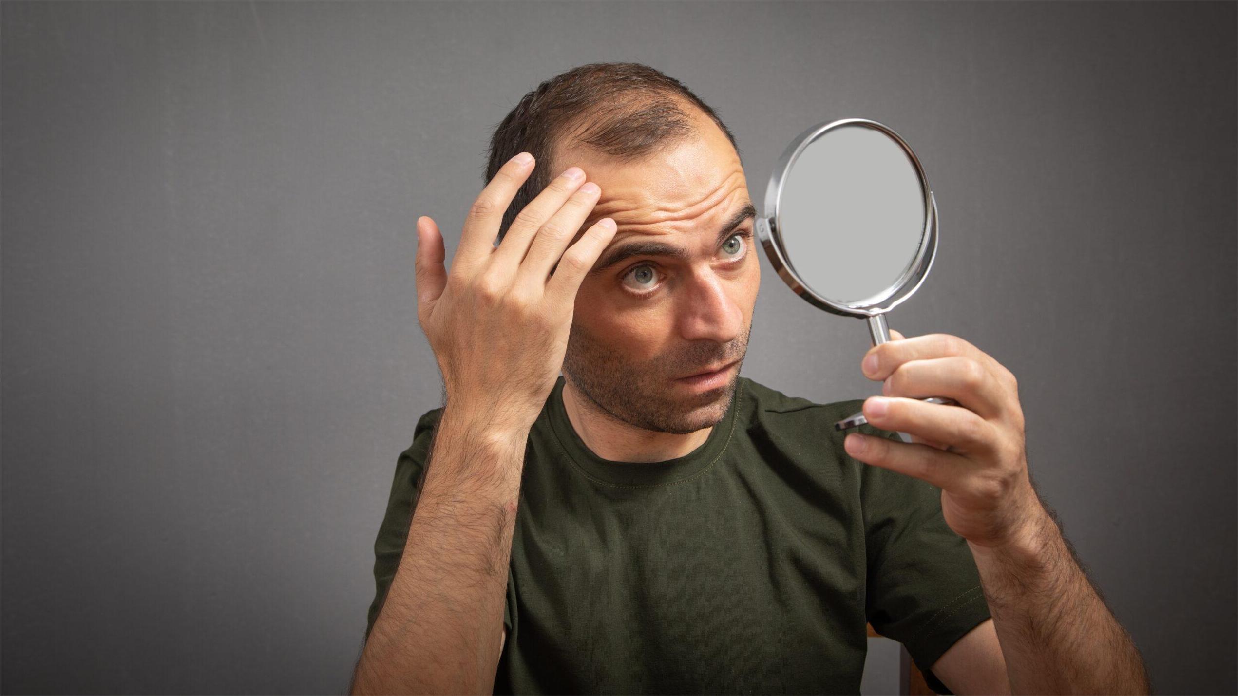 چه کسانی نمیتوانند کاشت مو انجام دهند